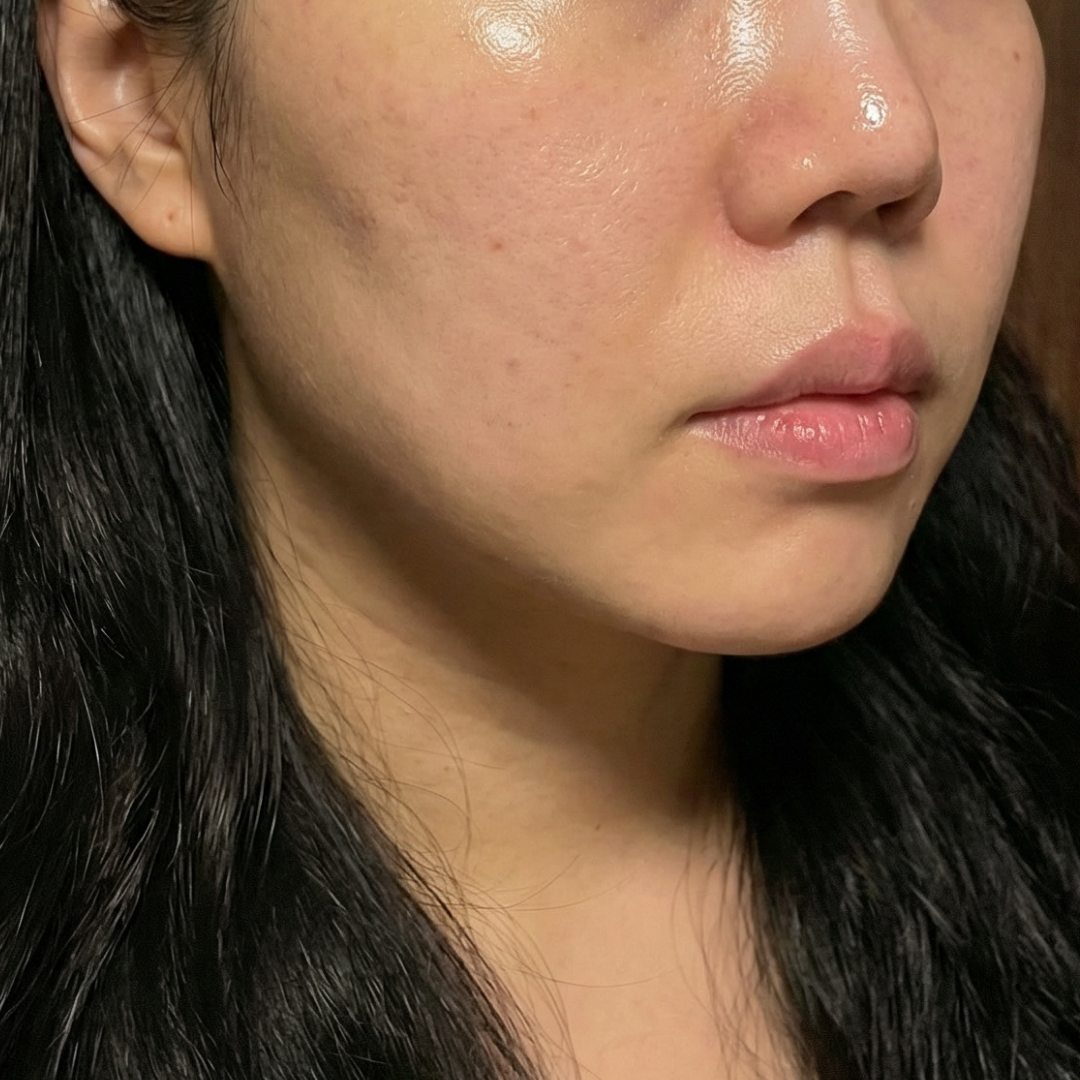 수술후기이미지