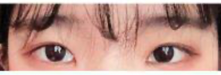 수술후기이미지