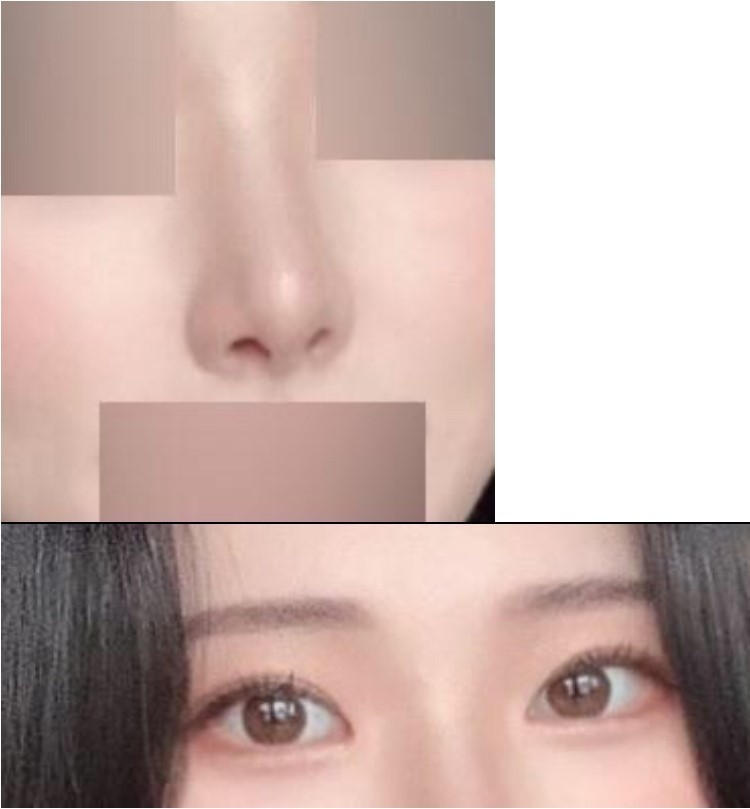 수술후기이미지