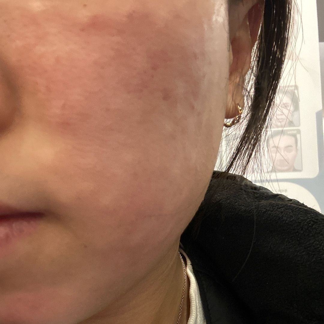 수술후기이미지