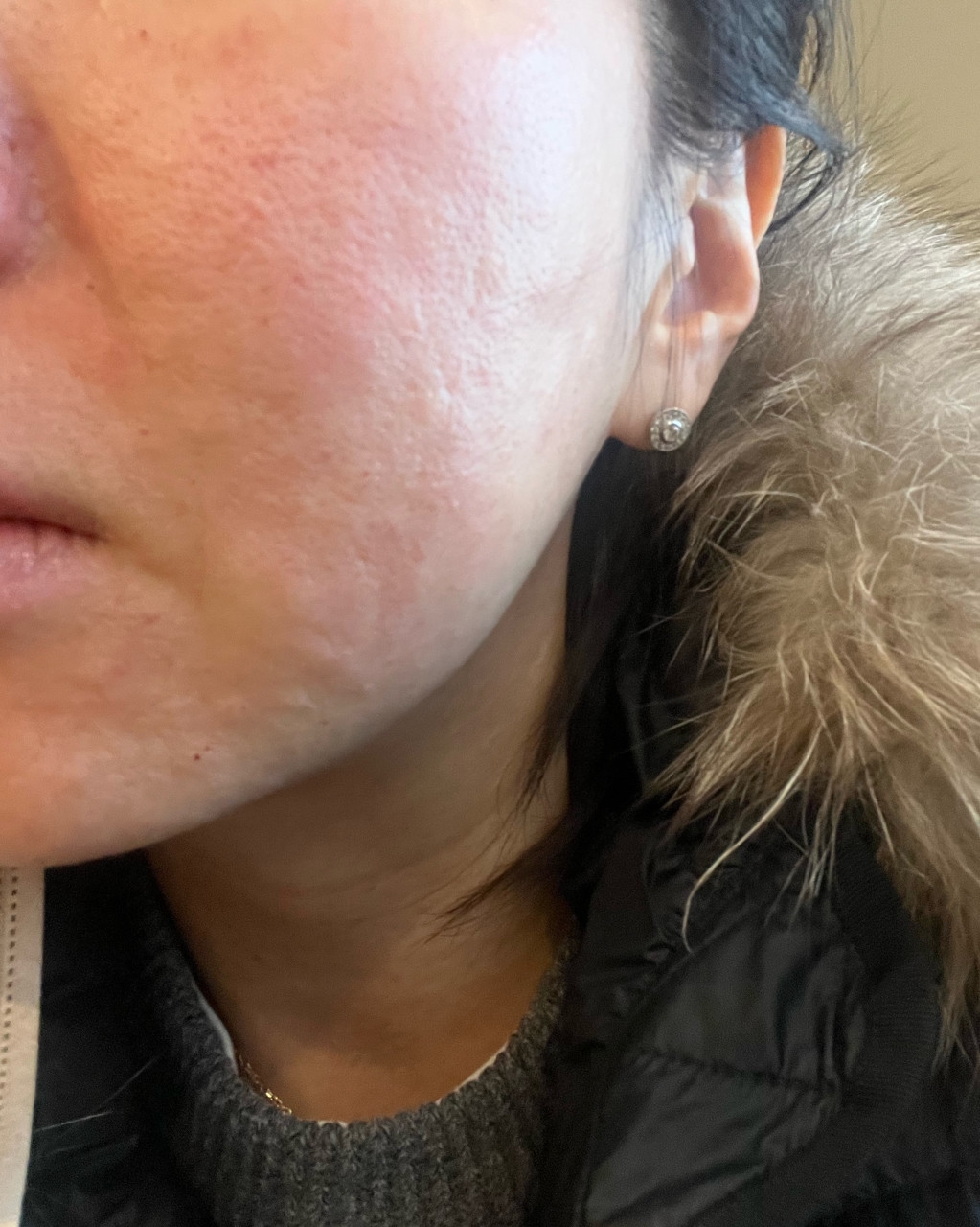 수술후기이미지