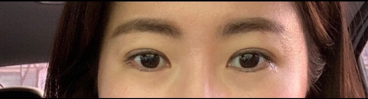 수술후기이미지