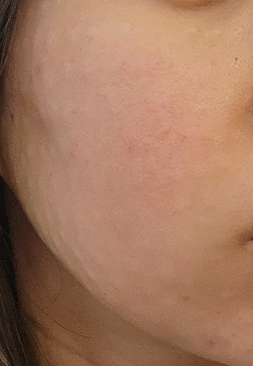 수술후기이미지