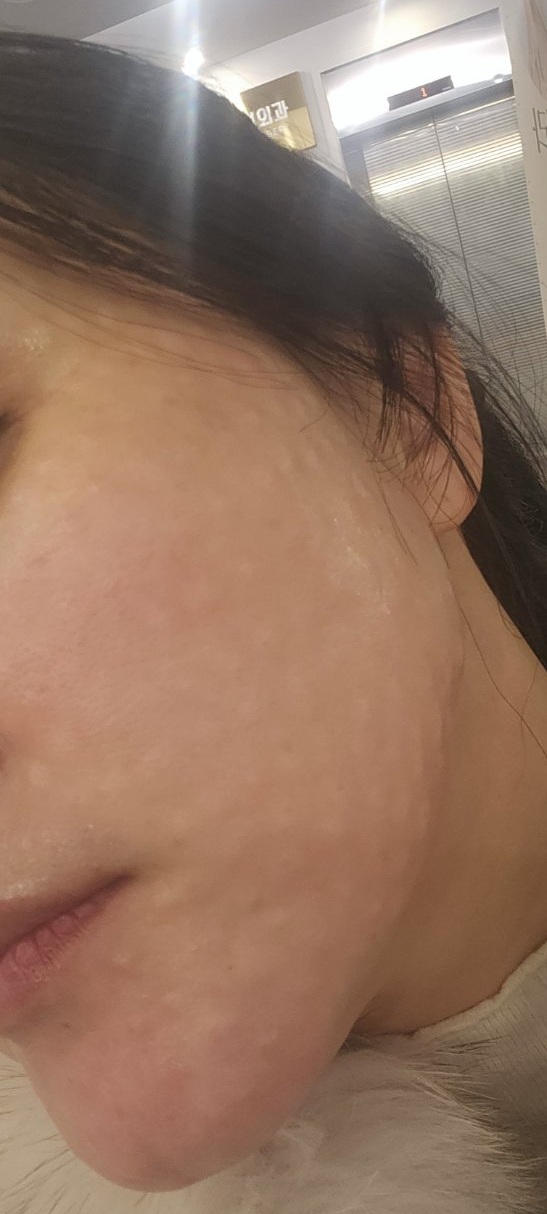 수술후기이미지