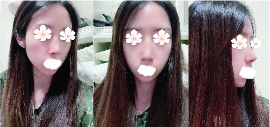 수술후기이미지