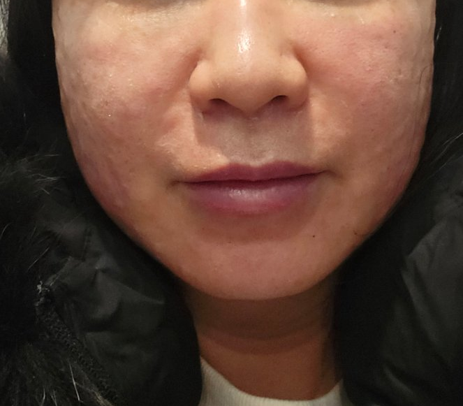 수술후기이미지