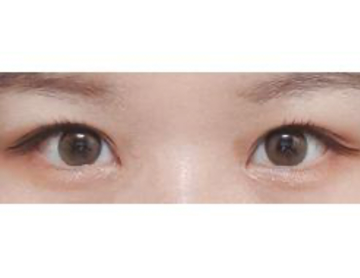 수술후기이미지