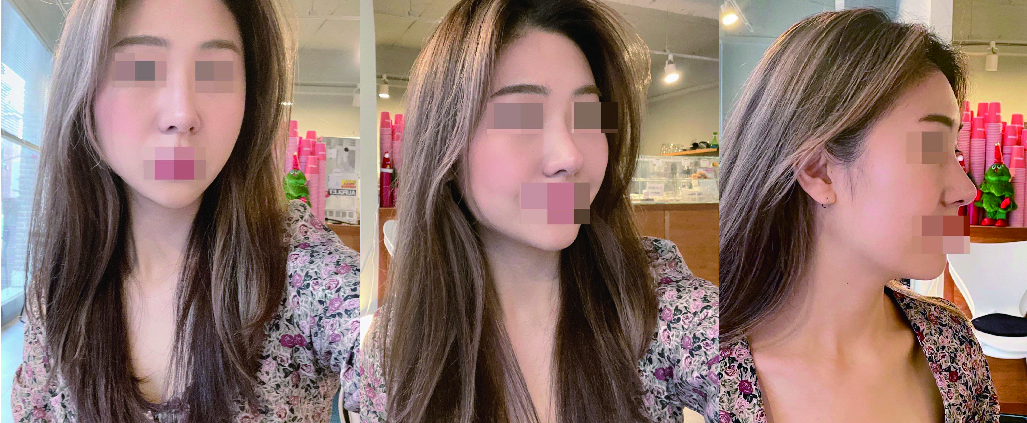 수술후기이미지