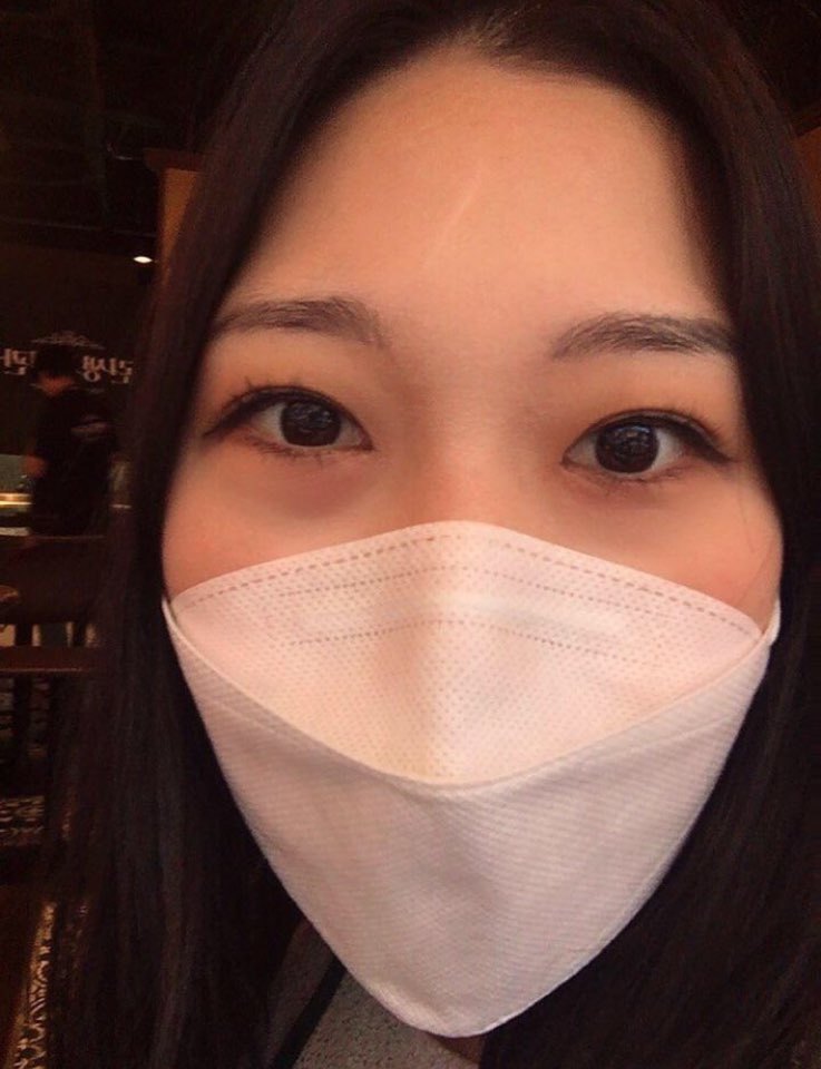 수술후기이미지