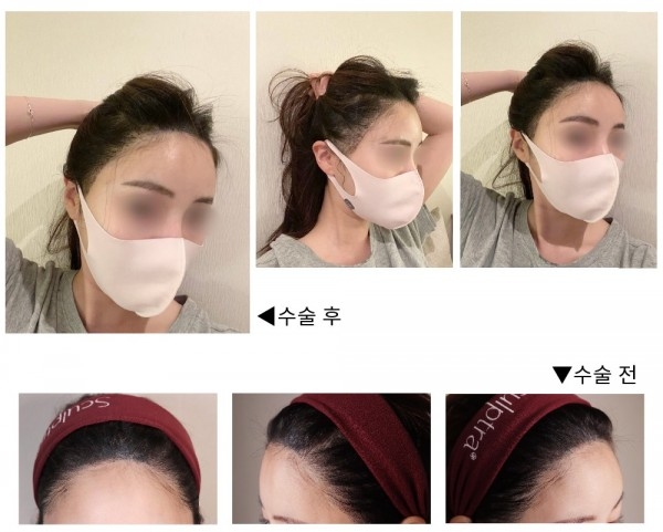 수술후기이미지