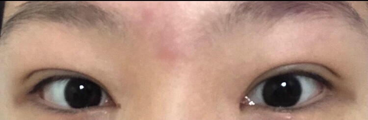 수술후기이미지