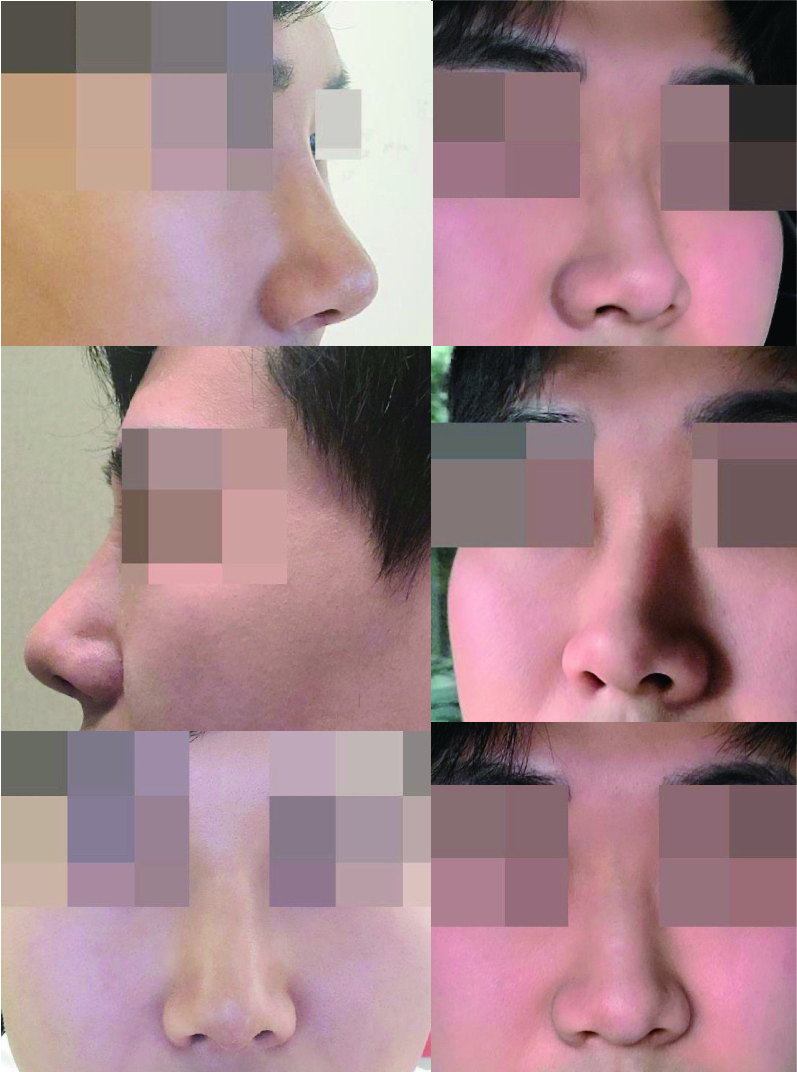 수술후기이미지