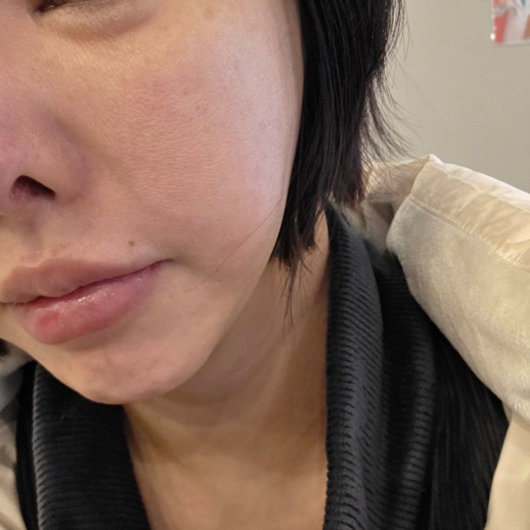 수술후기이미지