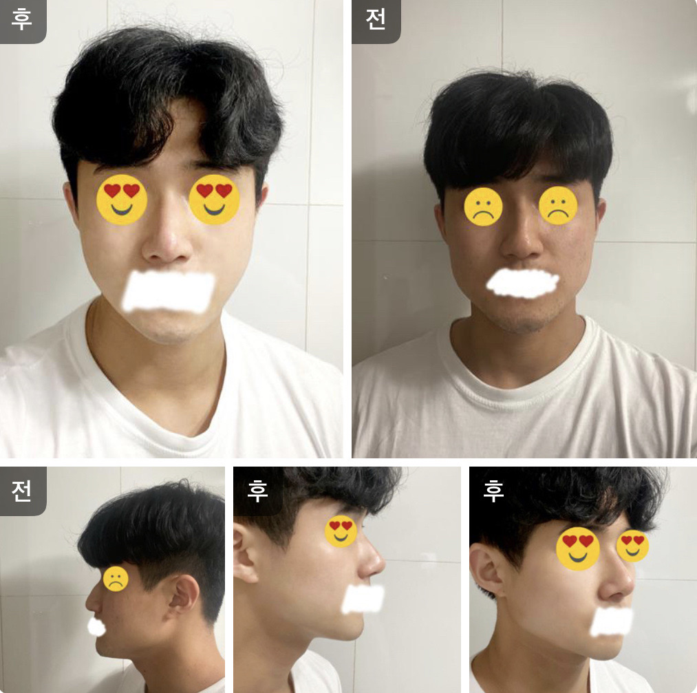 수술후기이미지