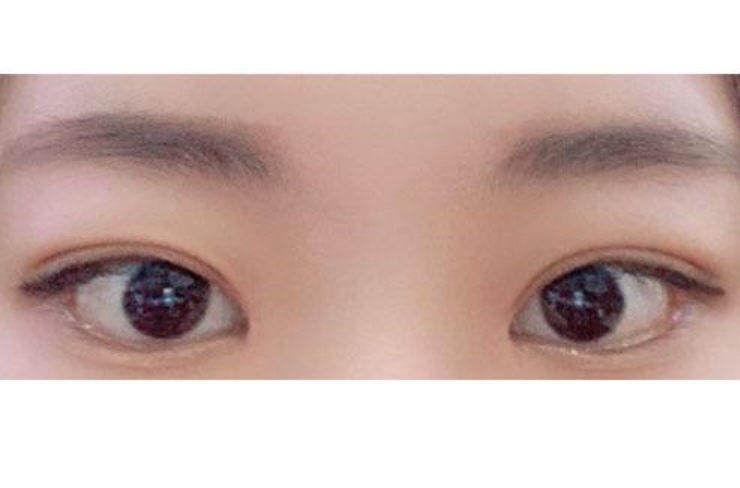 수술후기이미지