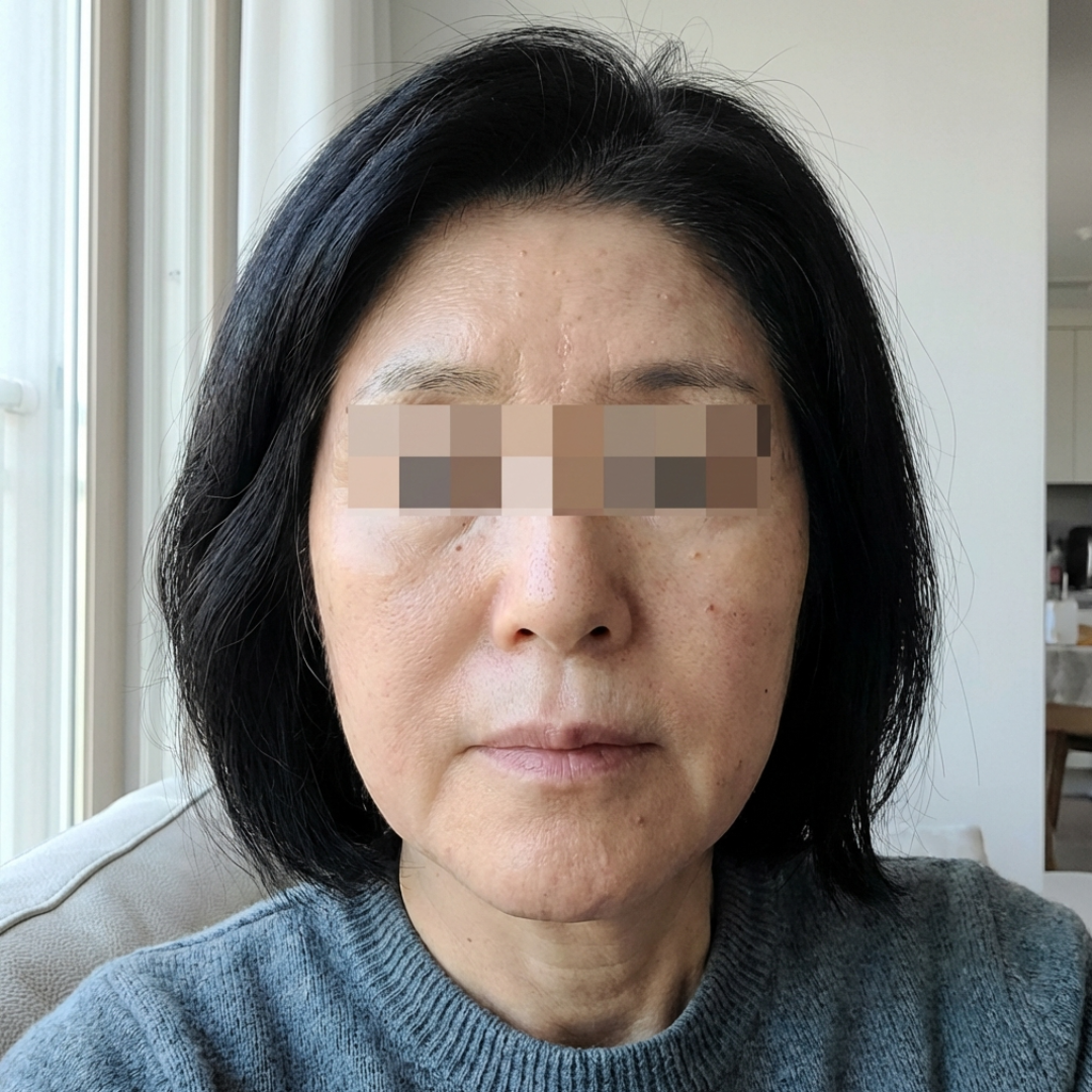 수술후기이미지