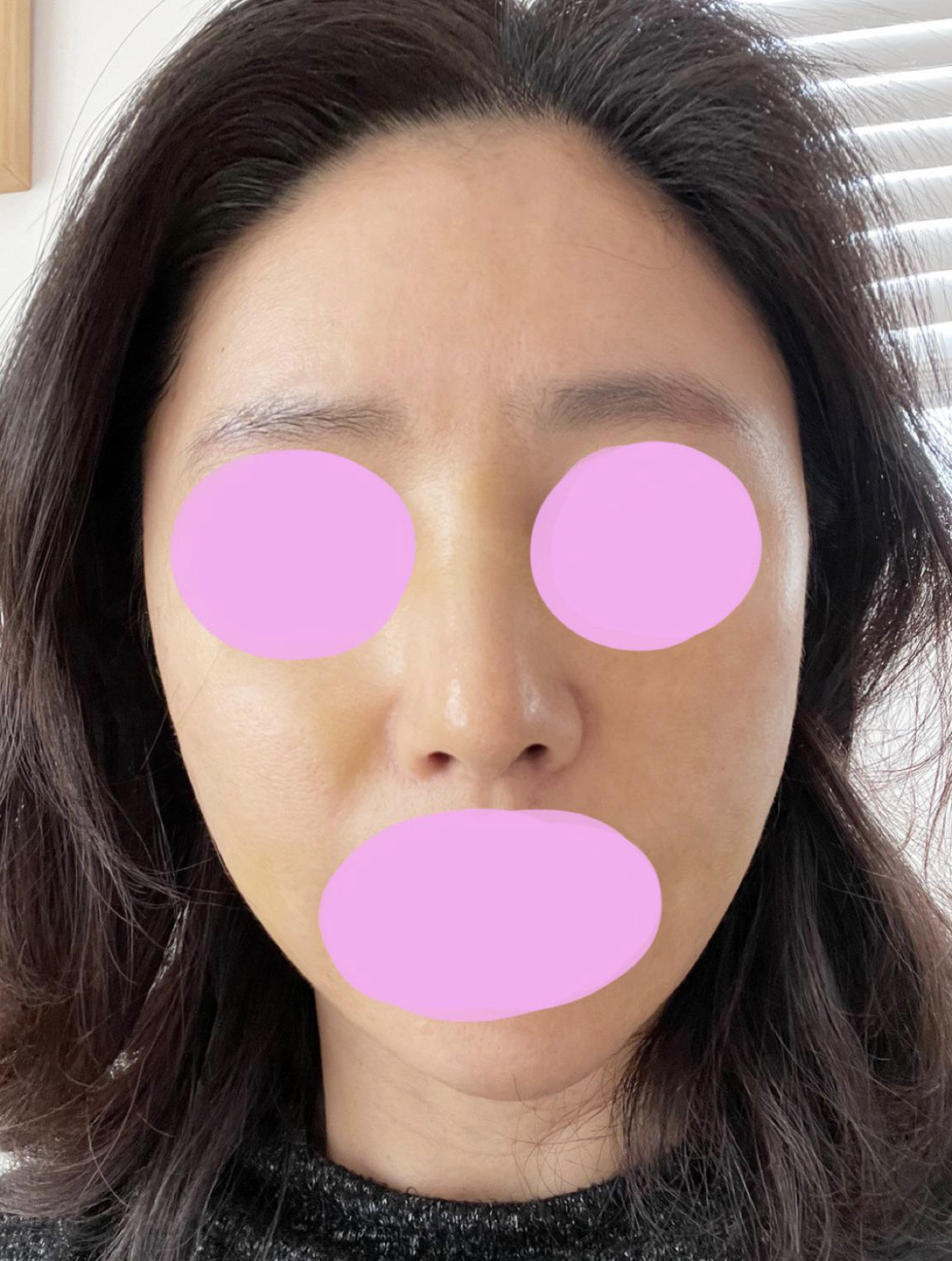 수술후기이미지