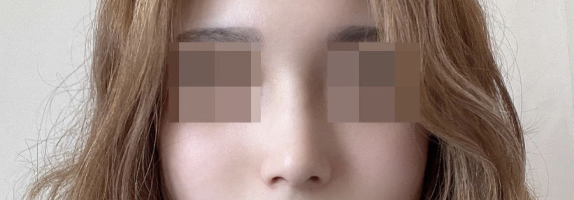 수술후기이미지