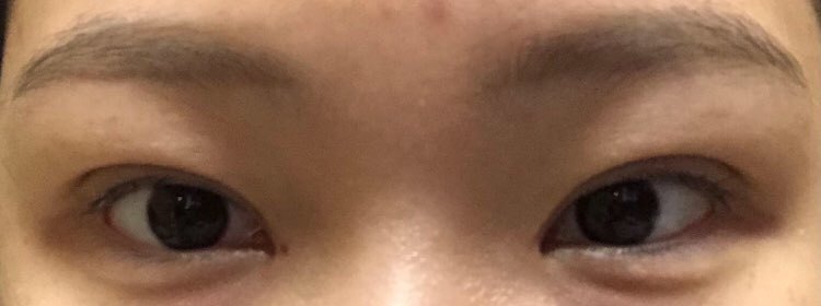 수술후기이미지