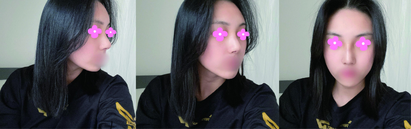 수술후기이미지