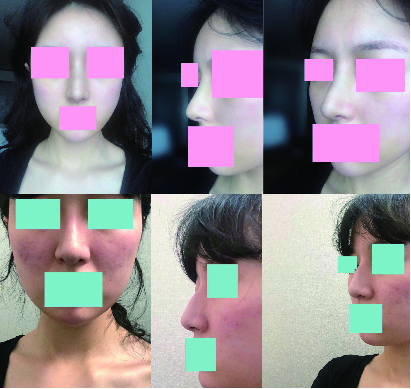 수술후기이미지