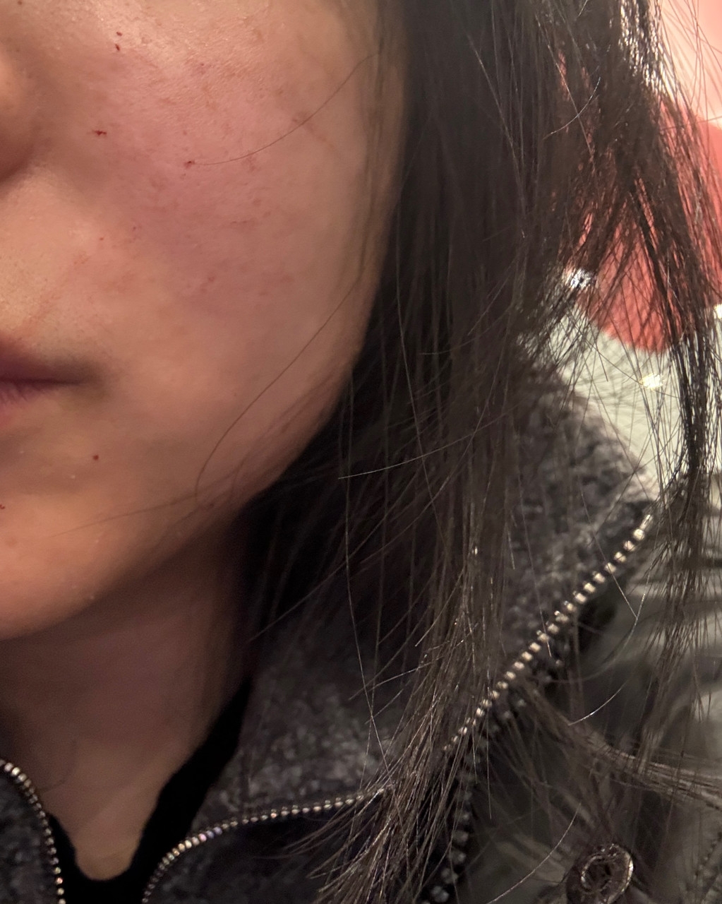 수술후기이미지