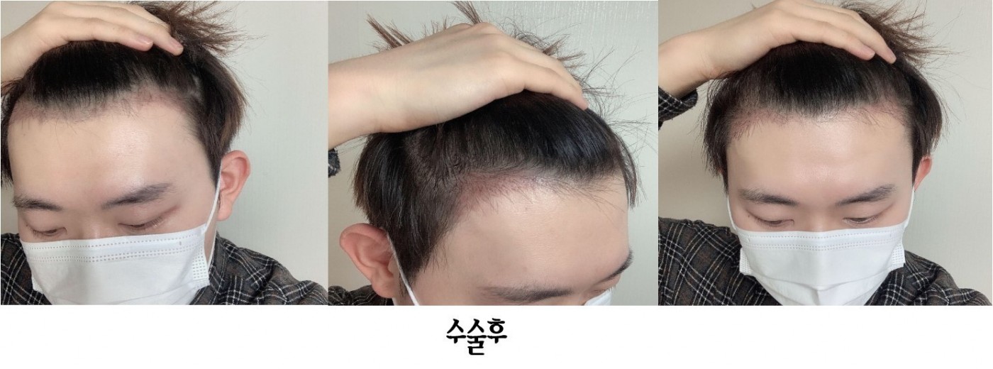 수술후기이미지